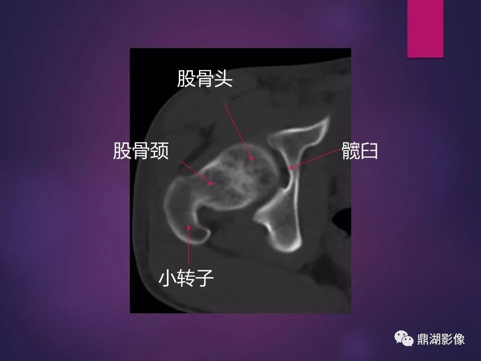 影像PPT - 【PPT】骨骼肌肉系统医学影像解剖-33