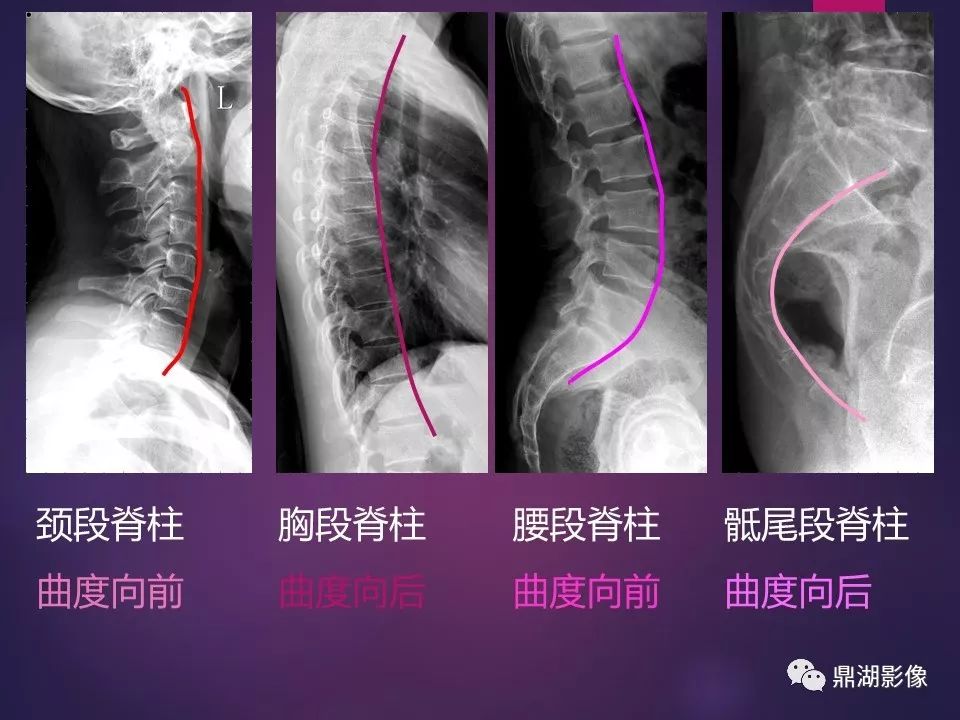 影像PPT - 【PPT】骨骼肌肉系统医学影像解剖-41