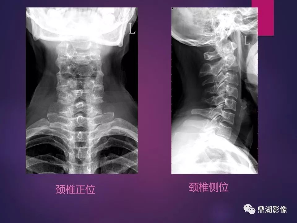 影像PPT - 【PPT】骨骼肌肉系统医学影像解剖-43