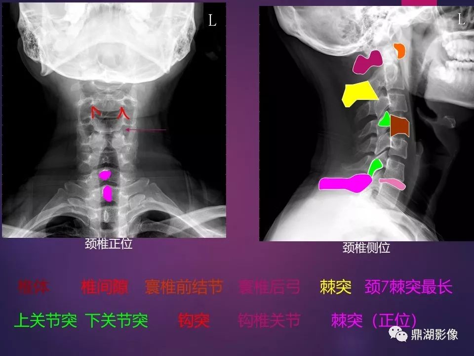 影像PPT - 【PPT】骨骼肌肉系统医学影像解剖-44