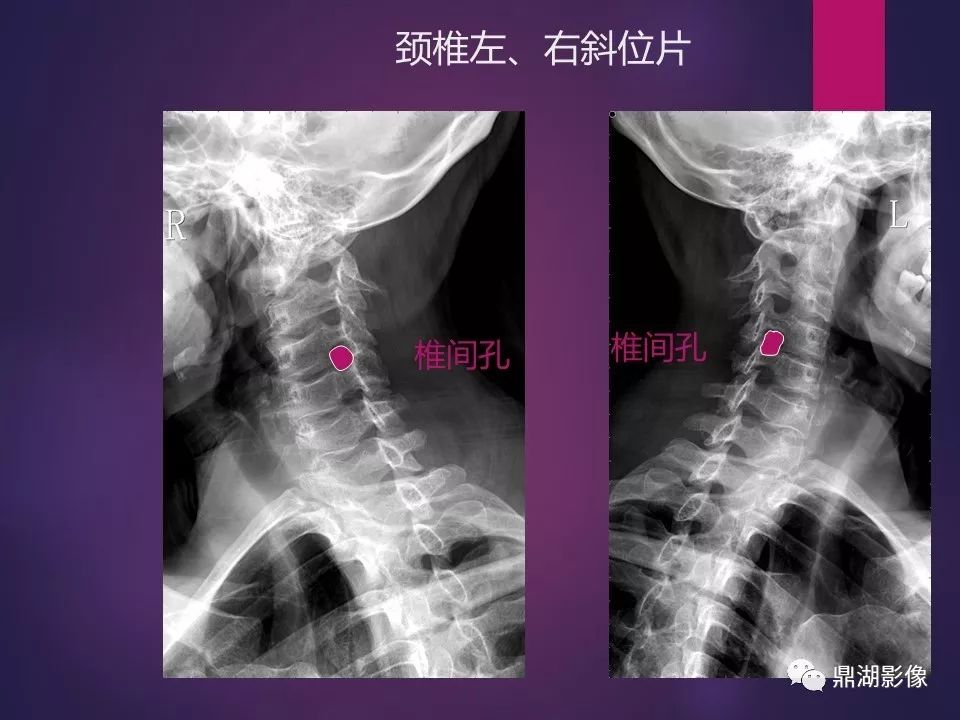 影像PPT - 【PPT】骨骼肌肉系统医学影像解剖-45