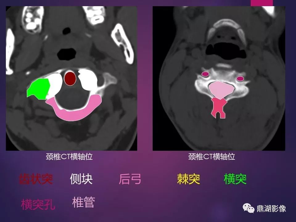 影像PPT - 【PPT】骨骼肌肉系统医学影像解剖-47