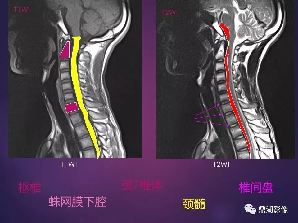 影像PPT - 【PPT】骨骼肌肉系统医学影像解剖-48