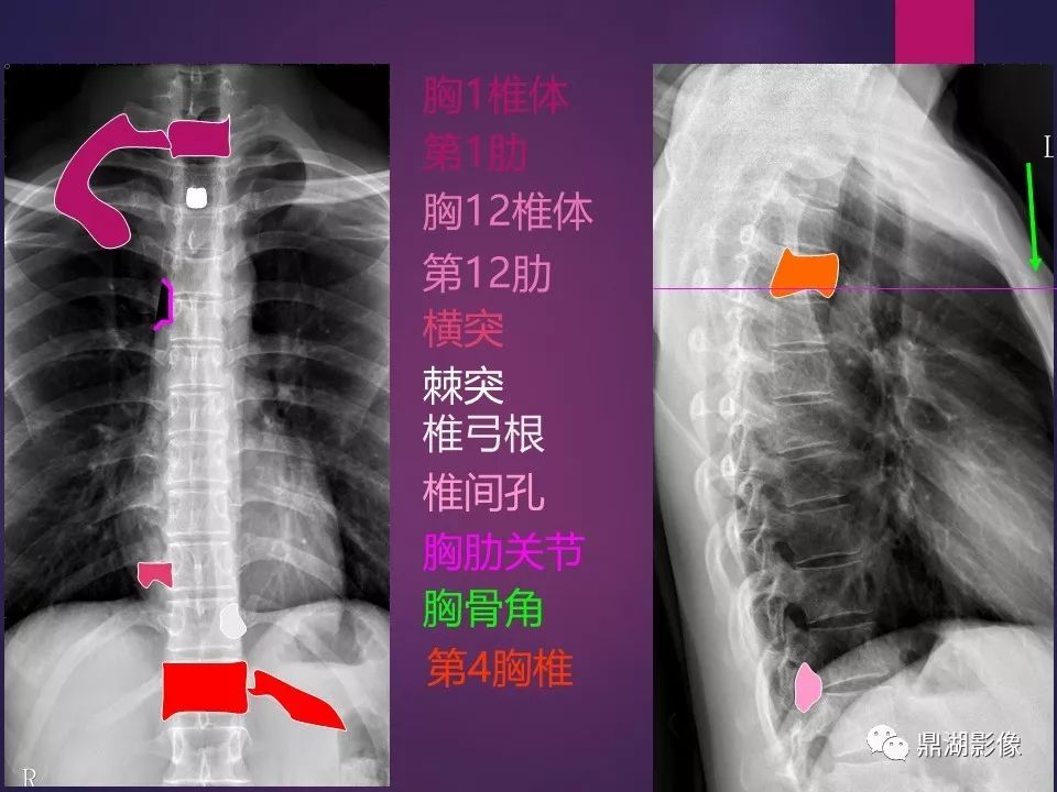 影像PPT - 【PPT】骨骼肌肉系统医学影像解剖-50