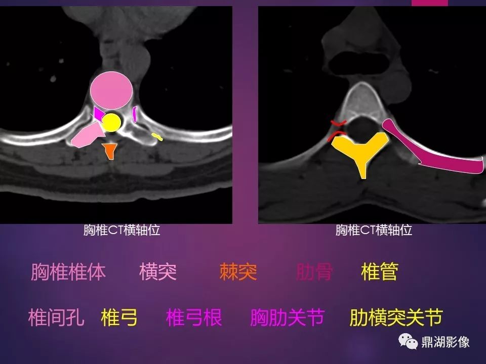 影像PPT - 【PPT】骨骼肌肉系统医学影像解剖-51