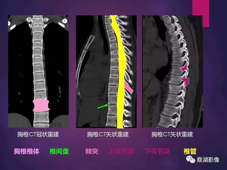 影像PPT - 【PPT】骨骼肌肉系统医学影像解剖-53