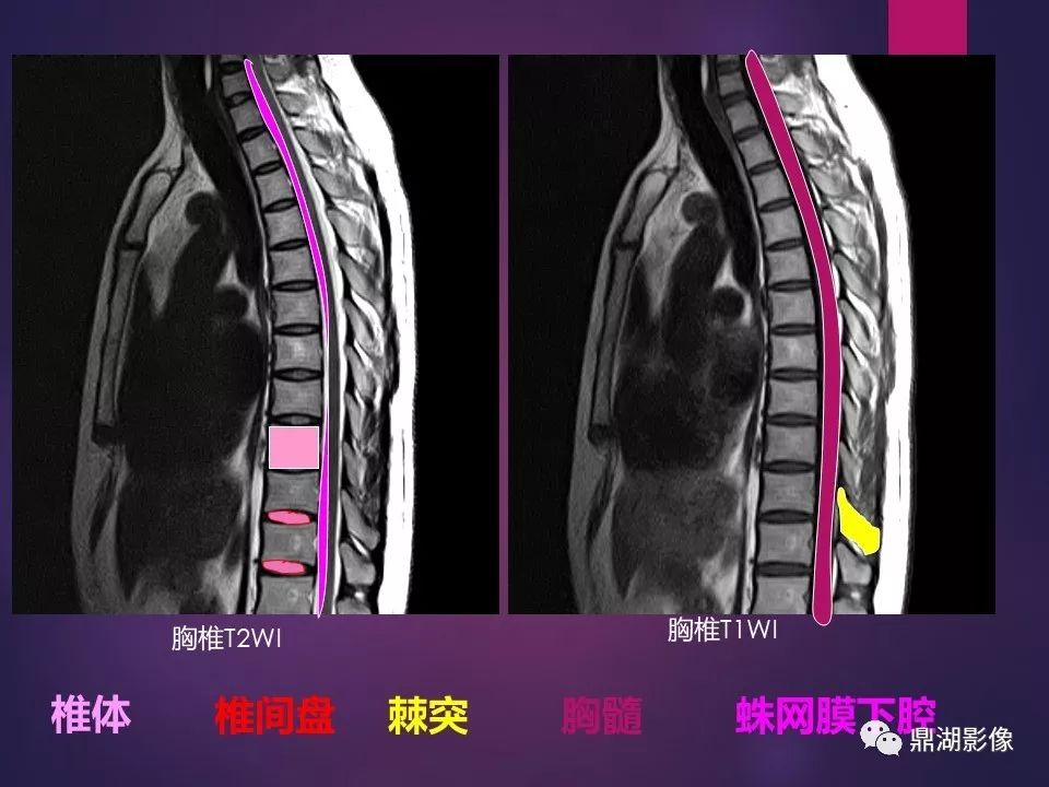 影像PPT - 【PPT】骨骼肌肉系统医学影像解剖-54