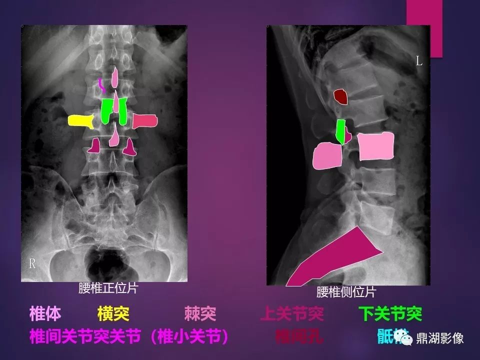 影像PPT - 【PPT】骨骼肌肉系统医学影像解剖-56