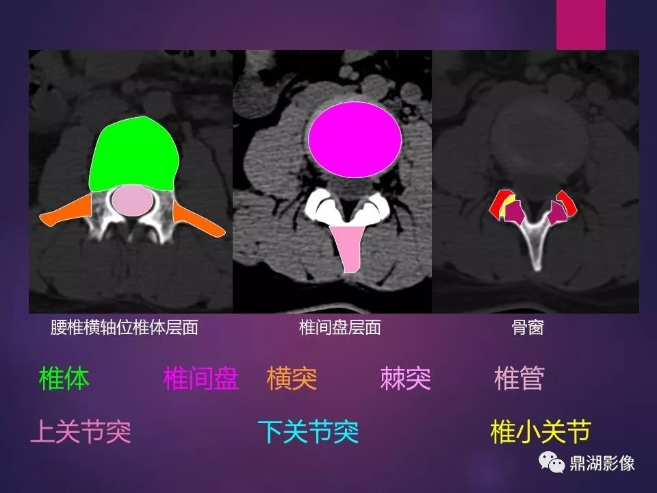 影像PPT - 【PPT】骨骼肌肉系统医学影像解剖-57