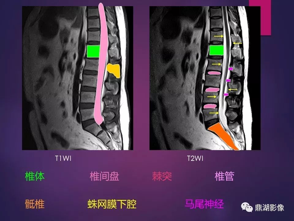 影像PPT - 【PPT】骨骼肌肉系统医学影像解剖-59