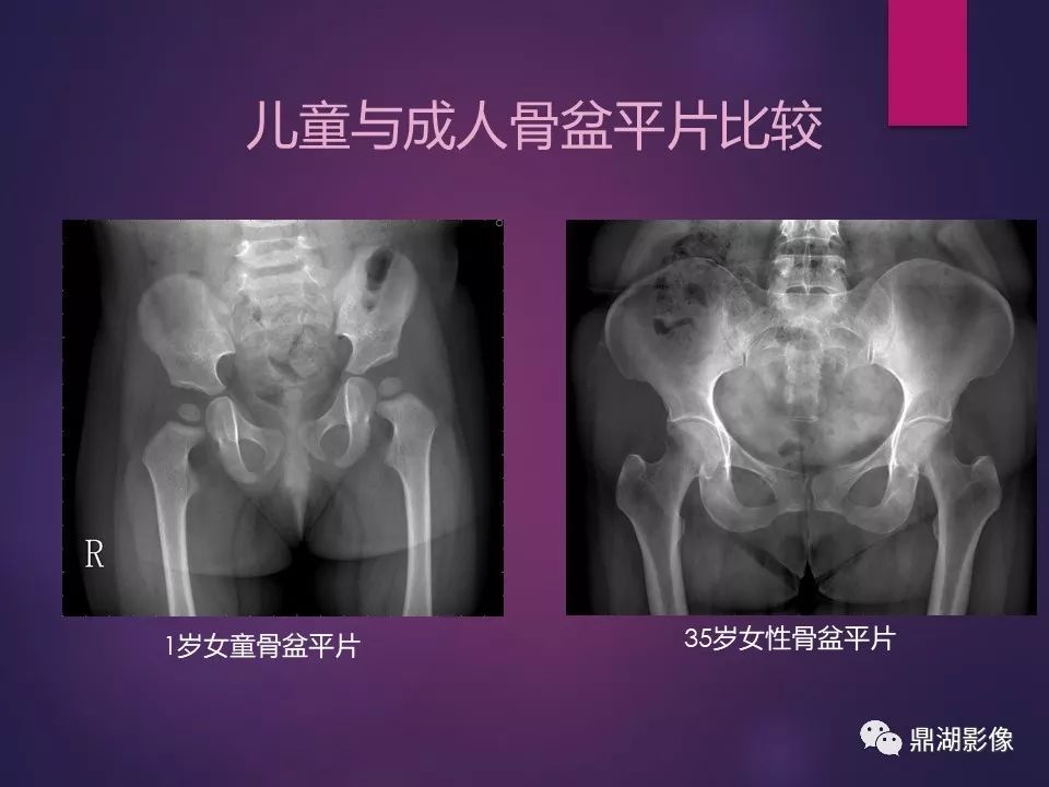 影像PPT - 【PPT】骨骼肌肉系统医学影像解剖-63