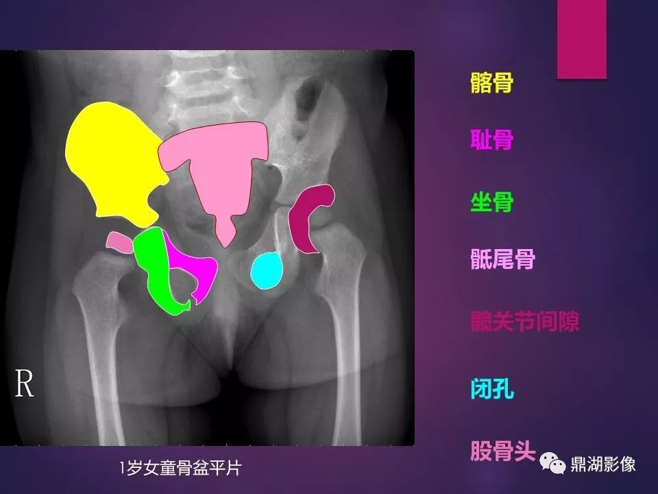 影像PPT - 【PPT】骨骼肌肉系统医学影像解剖-64