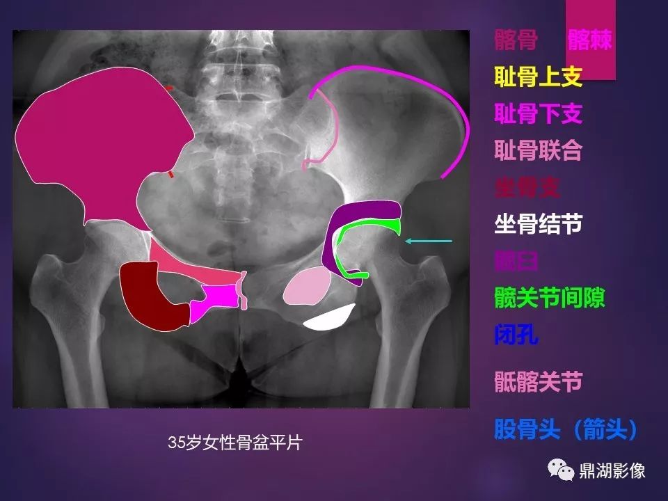 影像PPT - 【PPT】骨骼肌肉系统医学影像解剖-65