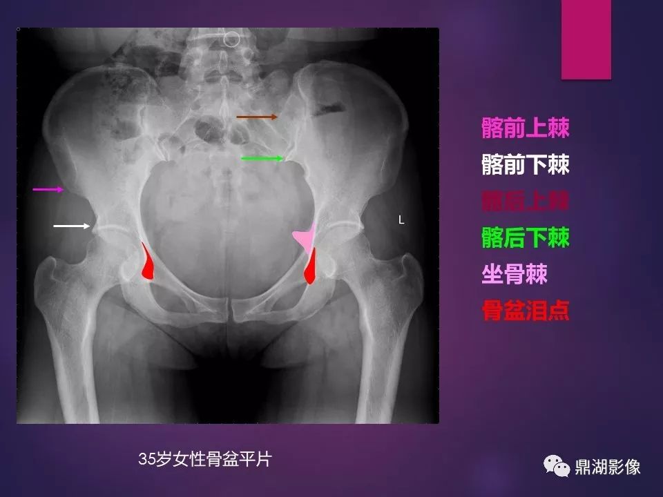 影像PPT - 【PPT】骨骼肌肉系统医学影像解剖-66