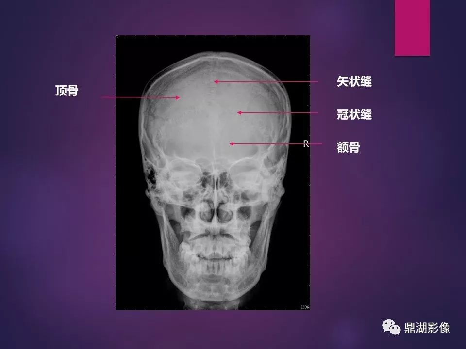 影像PPT - 【PPT】骨骼肌肉系统医学影像解剖-71