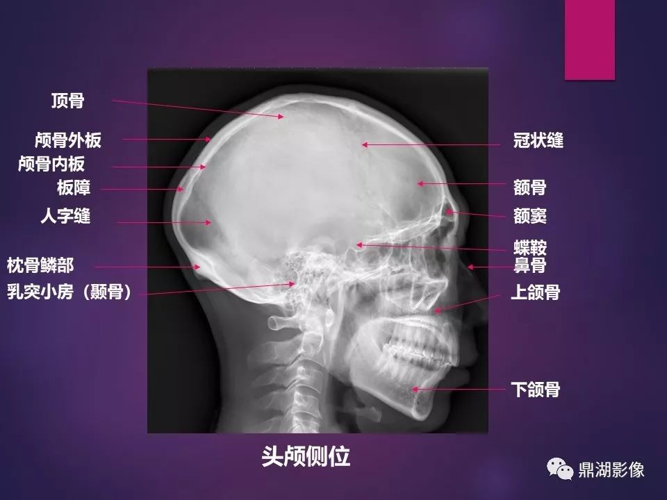 影像PPT - 【PPT】骨骼肌肉系统医学影像解剖-72
