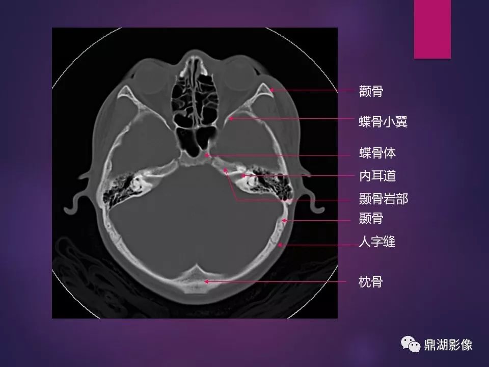 影像PPT - 【PPT】骨骼肌肉系统医学影像解剖-77