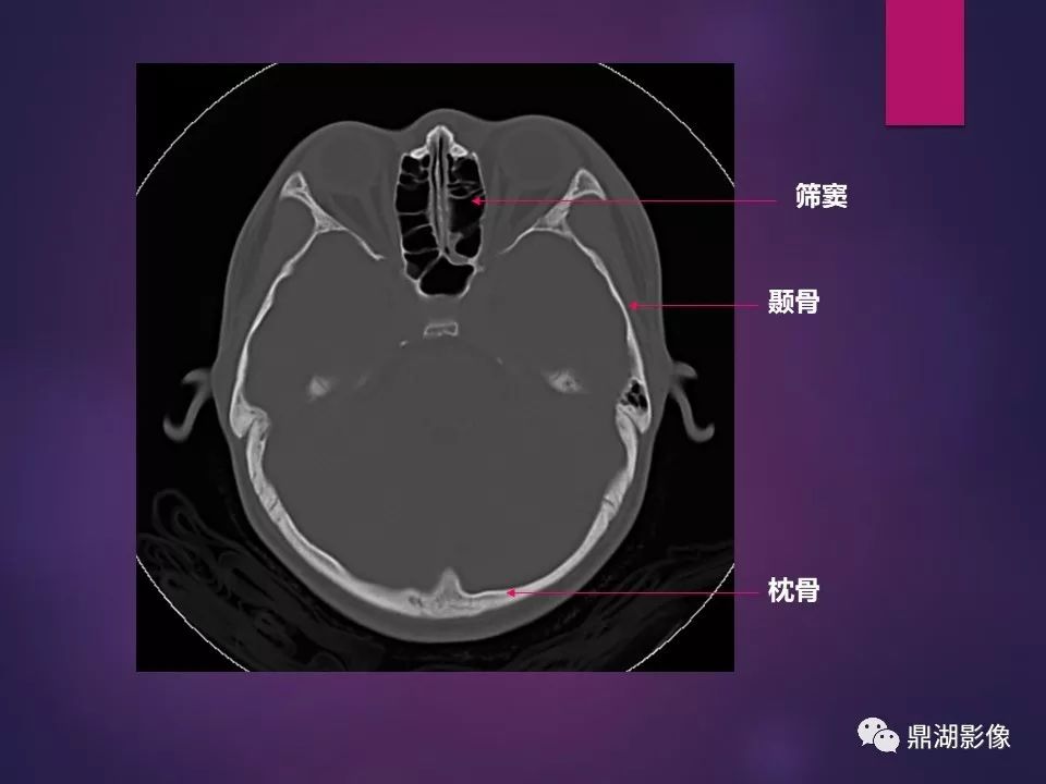影像PPT - 【PPT】骨骼肌肉系统医学影像解剖-78