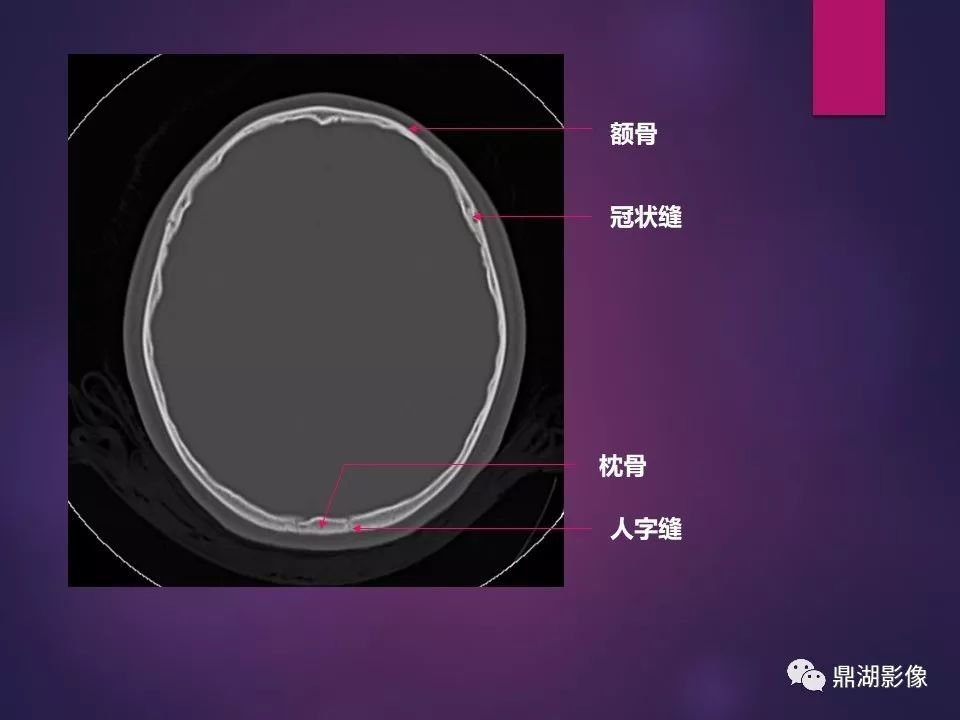 影像PPT - 【PPT】骨骼肌肉系统医学影像解剖-83