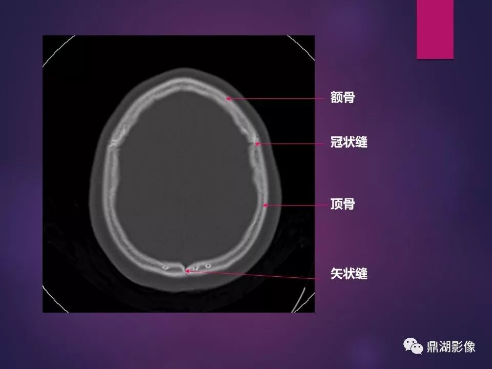 影像PPT - 【PPT】骨骼肌肉系统医学影像解剖-85