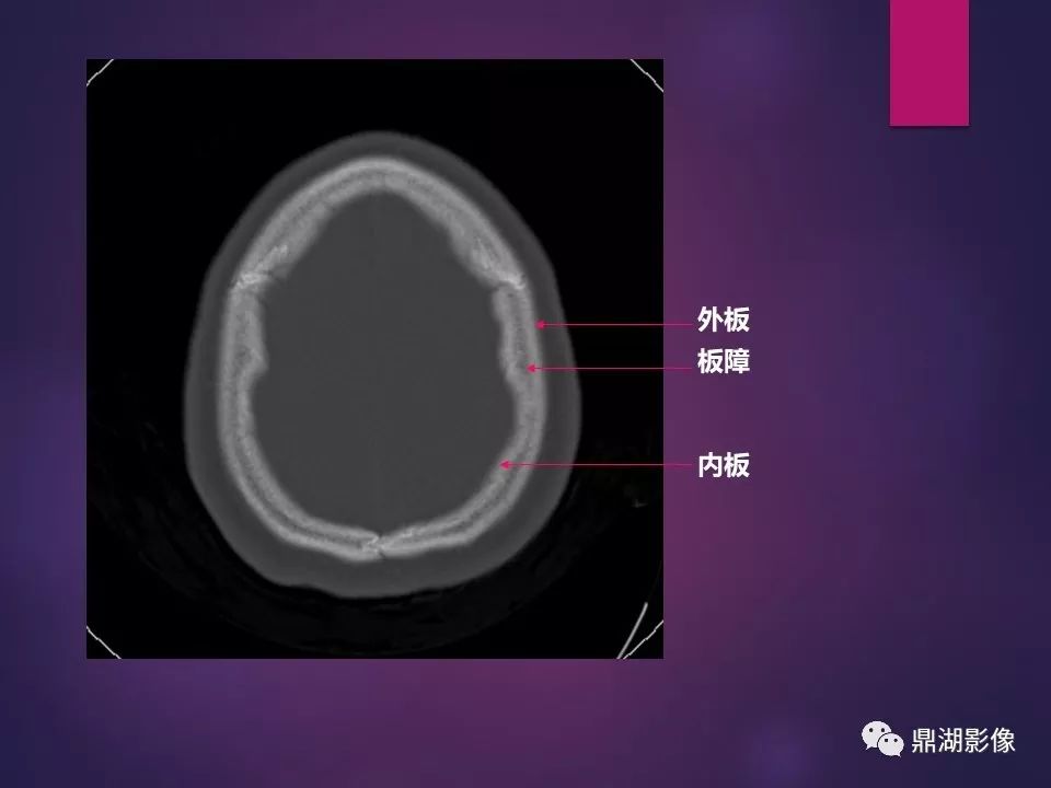 影像PPT - 【PPT】骨骼肌肉系统医学影像解剖-86