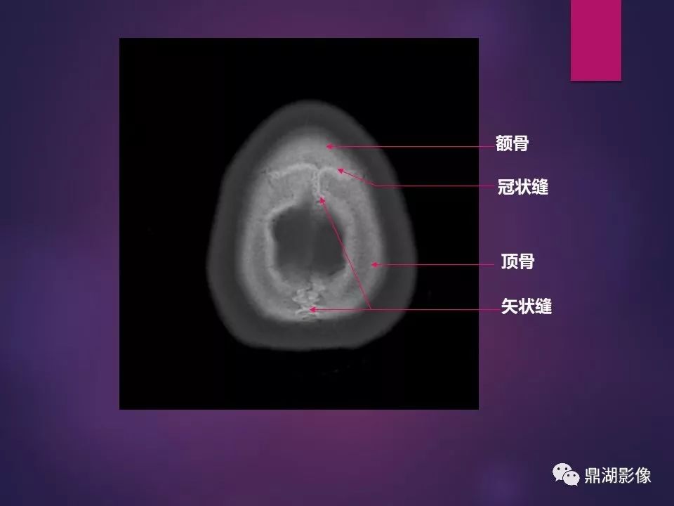 影像PPT - 【PPT】骨骼肌肉系统医学影像解剖-88