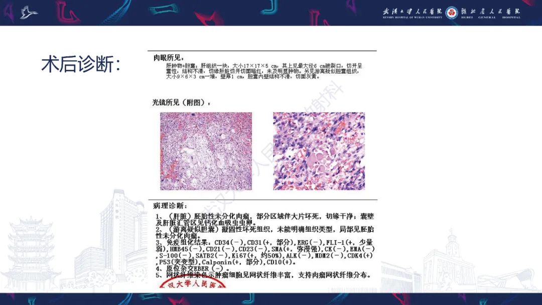 影像PPT - 【PPT】肝脏未分化胚胎性肉瘤-8