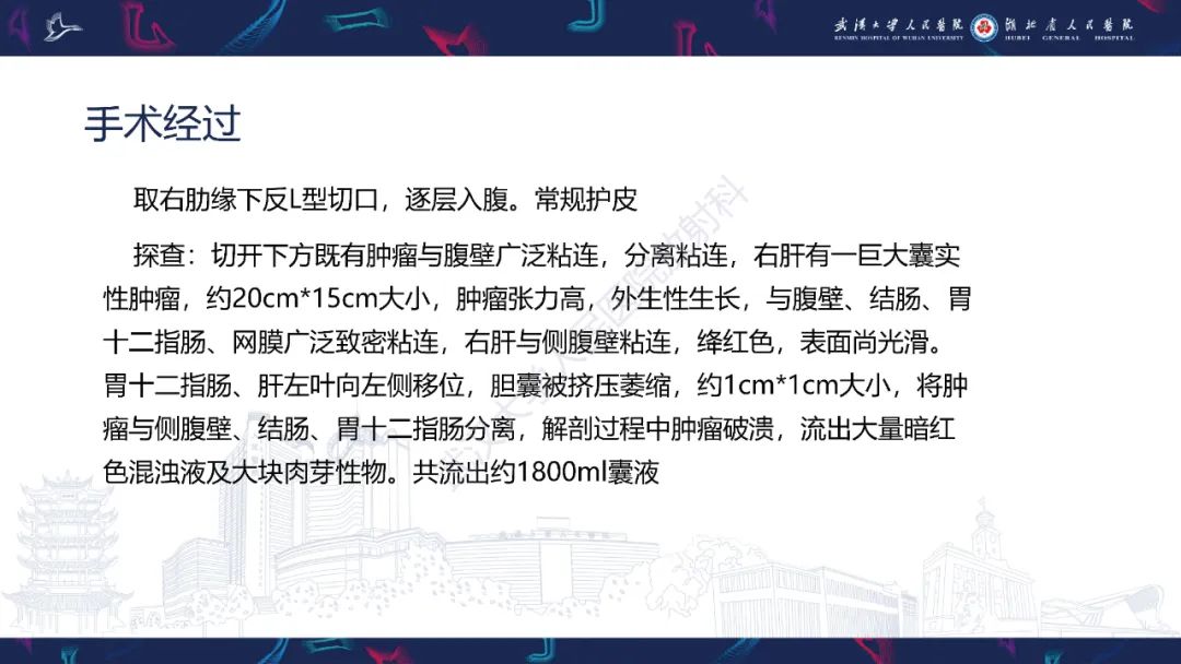 影像PPT - 【PPT】肝脏未分化胚胎性肉瘤-7
