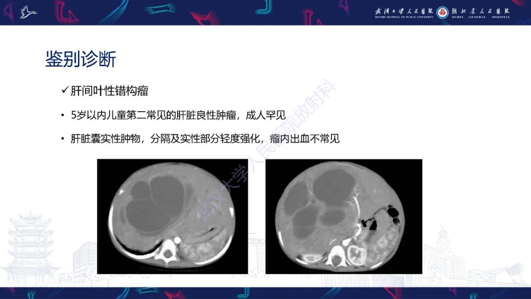 影像PPT - 【PPT】肝脏未分化胚胎性肉瘤-21