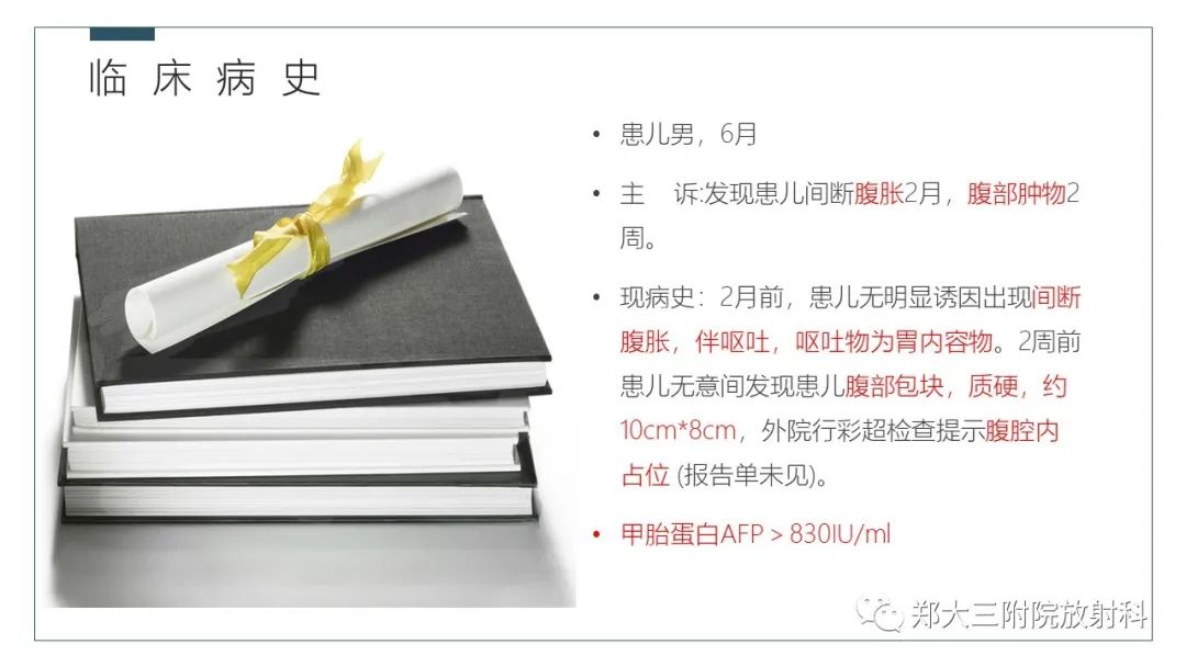 影像PPT - 【病例】肝母细胞瘤1例CT影像-3