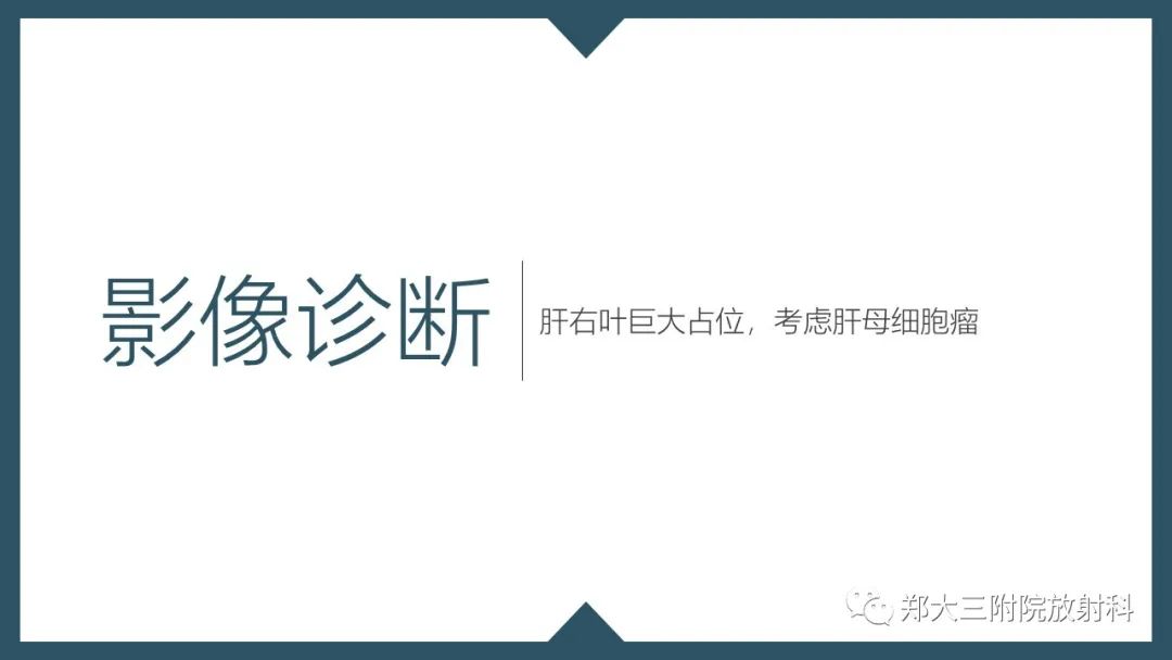 影像PPT - 【病例】肝母细胞瘤1例CT影像-8