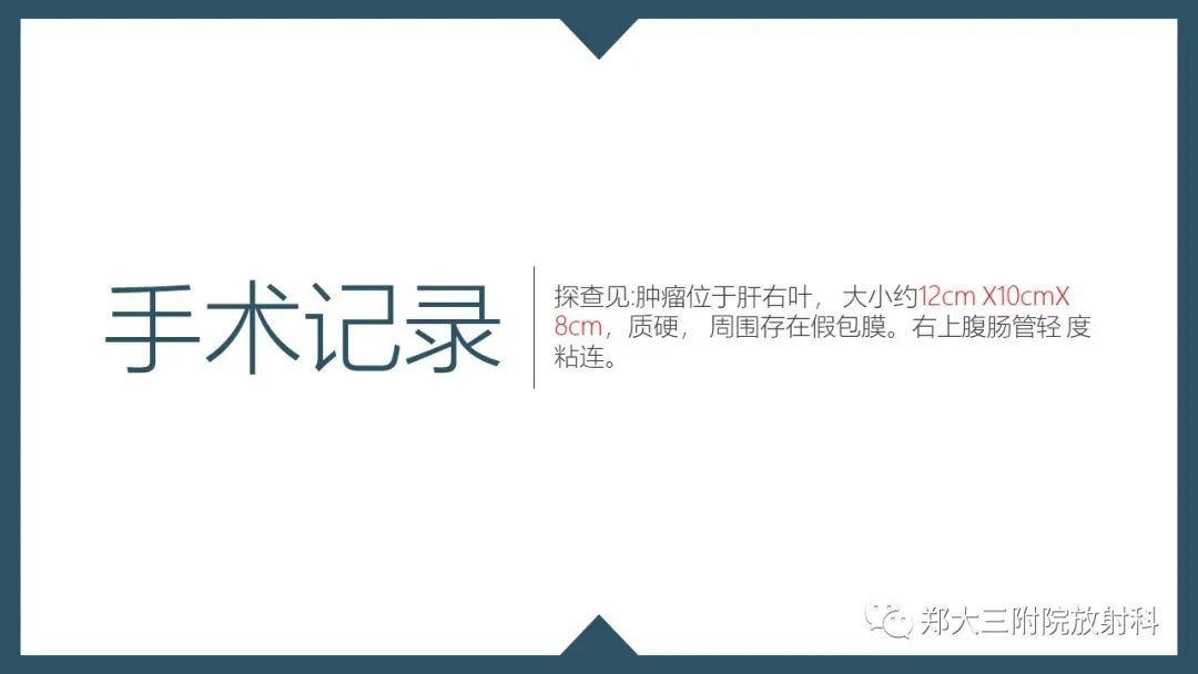 影像PPT - 【病例】肝母细胞瘤1例CT影像-9