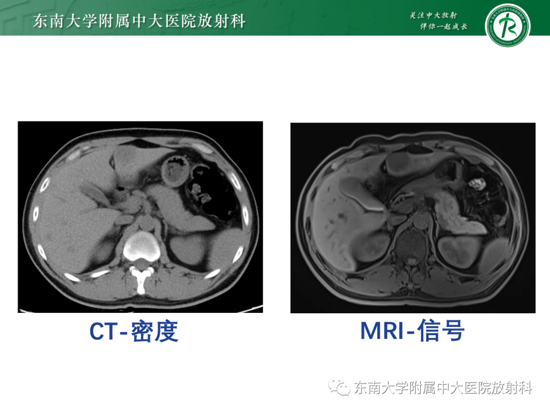 影像PPT - 【PPT】CT及MR对比剂种类、临床应用及常见副反应-4