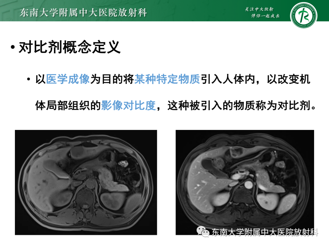 影像PPT - 【PPT】CT及MR对比剂种类、临床应用及常见副反应-5
