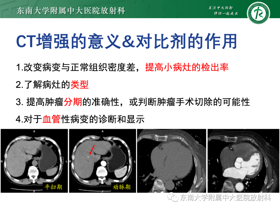 影像PPT - 【PPT】CT及MR对比剂种类、临床应用及常见副反应-7