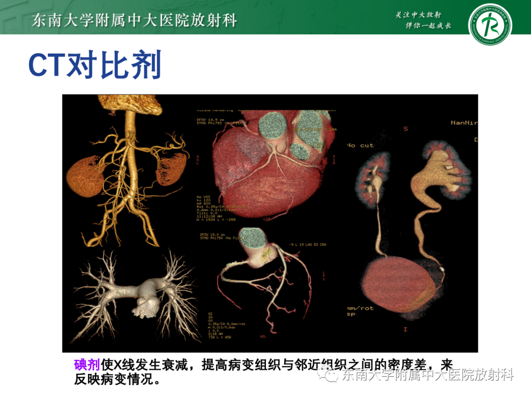 影像PPT - 【PPT】CT及MR对比剂种类、临床应用及常见副反应-8