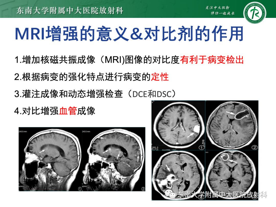 影像PPT - 【PPT】CT及MR对比剂种类、临床应用及常见副反应-9