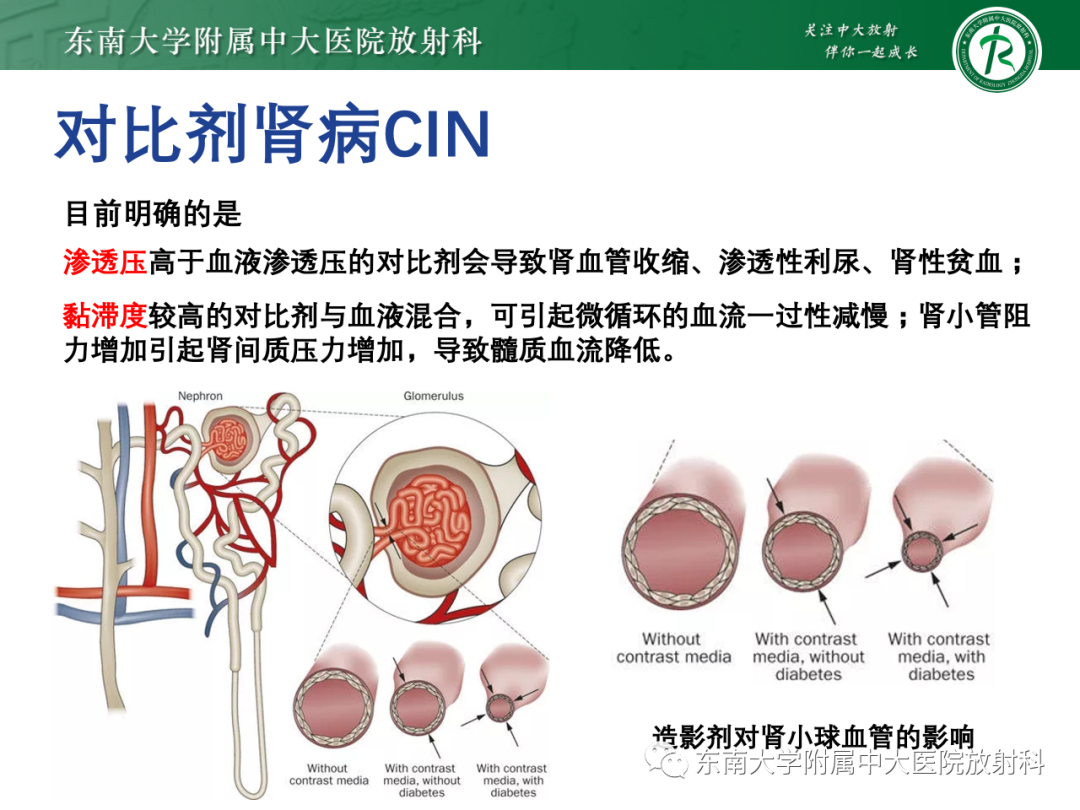 影像PPT - 【PPT】CT及MR对比剂种类、临床应用及常见副反应-76