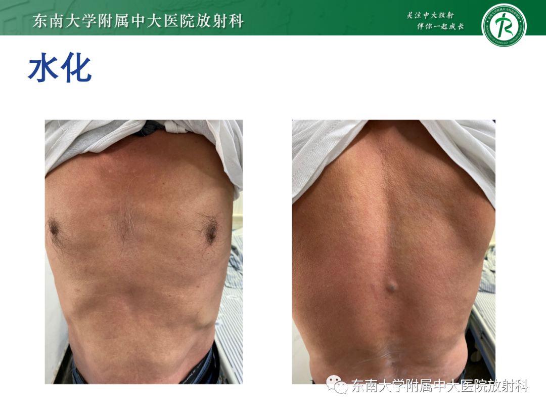 影像PPT - 【PPT】CT及MR对比剂种类、临床应用及常见副反应-81