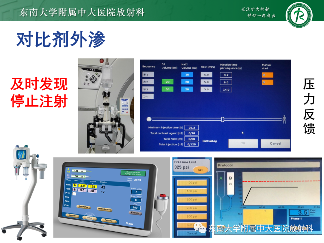 影像PPT - 【PPT】CT及MR对比剂种类、临床应用及常见副反应-96