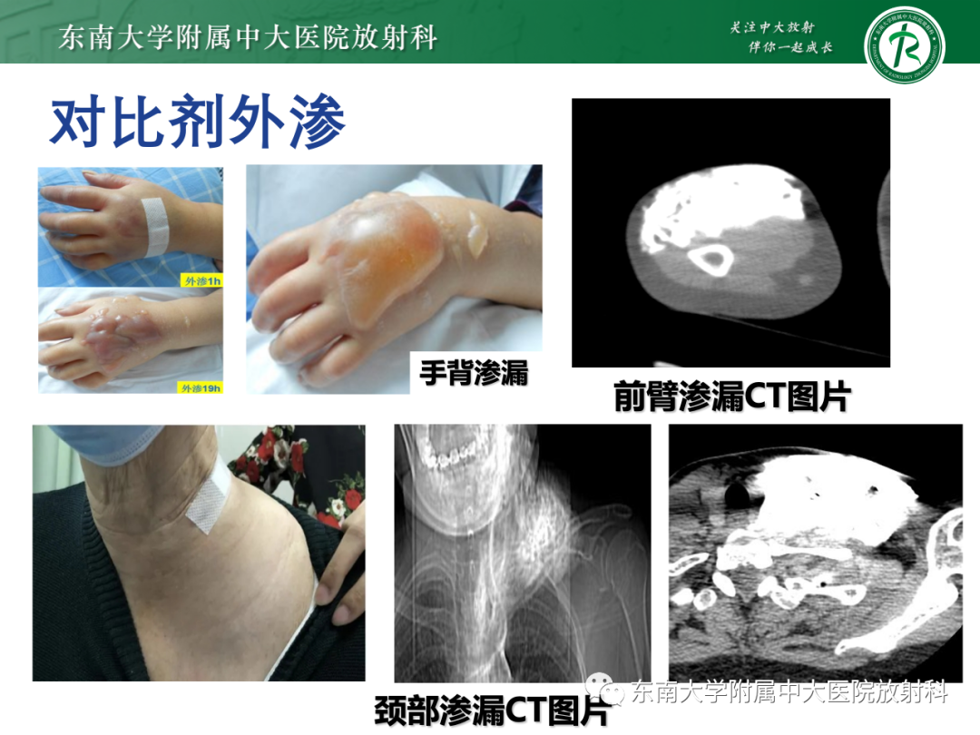 影像PPT - 【PPT】CT及MR对比剂种类、临床应用及常见副反应-98