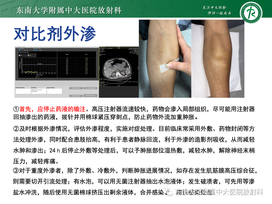 影像PPT - 【PPT】CT及MR对比剂种类、临床应用及常见副反应-99