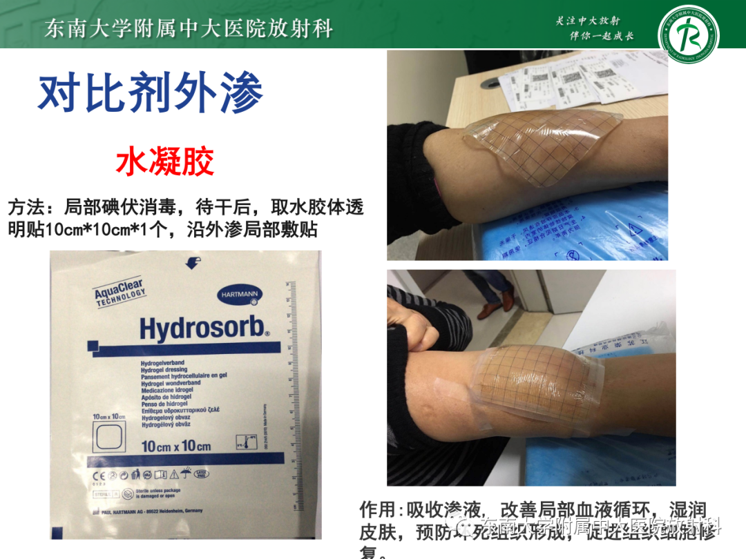 影像PPT - 【PPT】CT及MR对比剂种类、临床应用及常见副反应-101