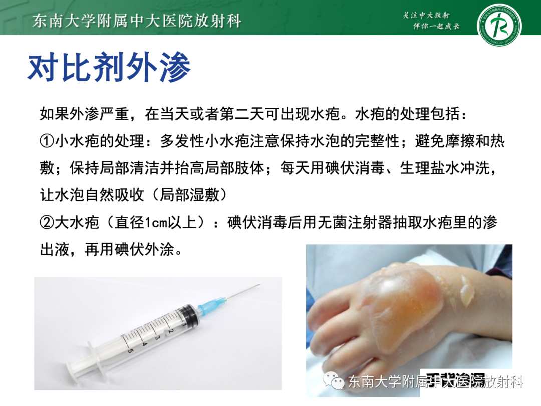 影像PPT - 【PPT】CT及MR对比剂种类、临床应用及常见副反应-104