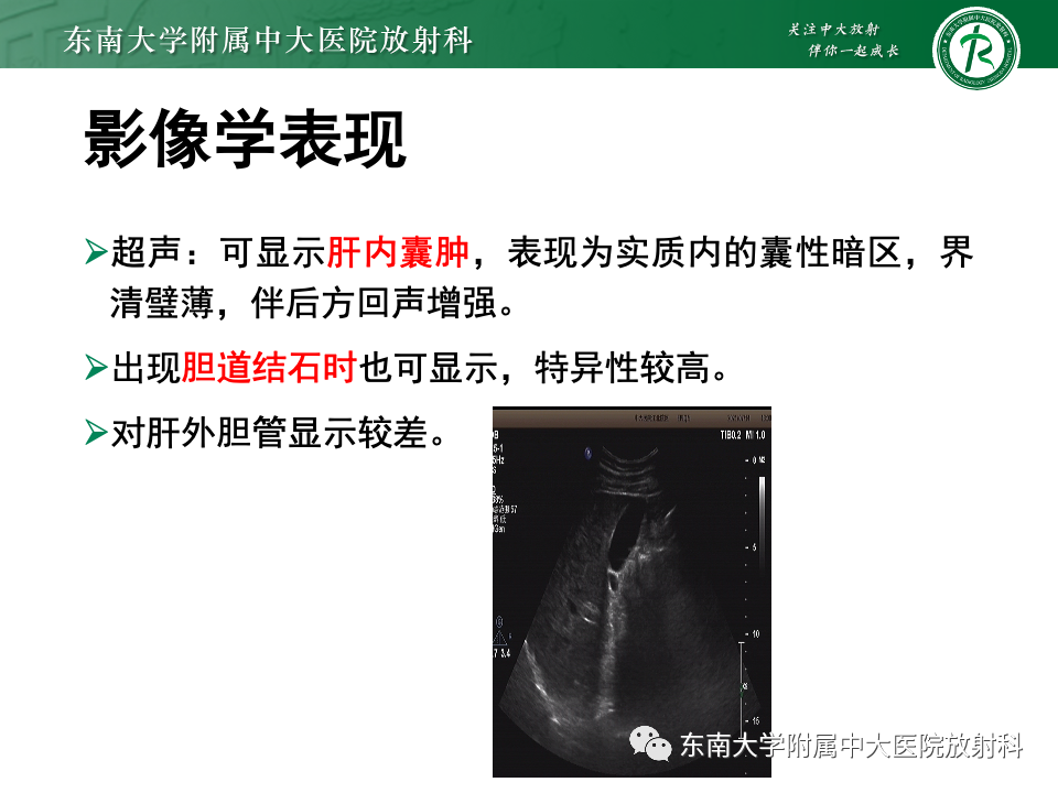 影像PPT - 【PPT】Caroli病-9