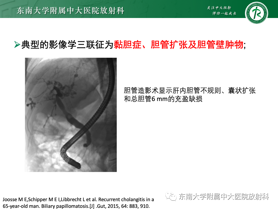 影像PPT - 【PPT】Caroli病-30