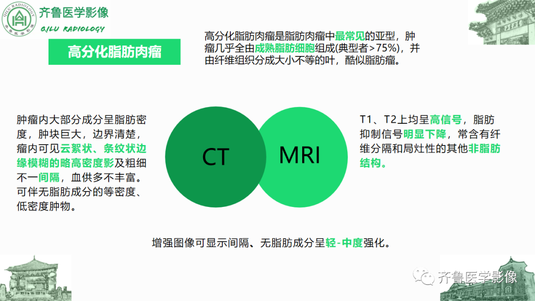 影像PPT - 【PPT】腹膜及腹膜后病变-13
