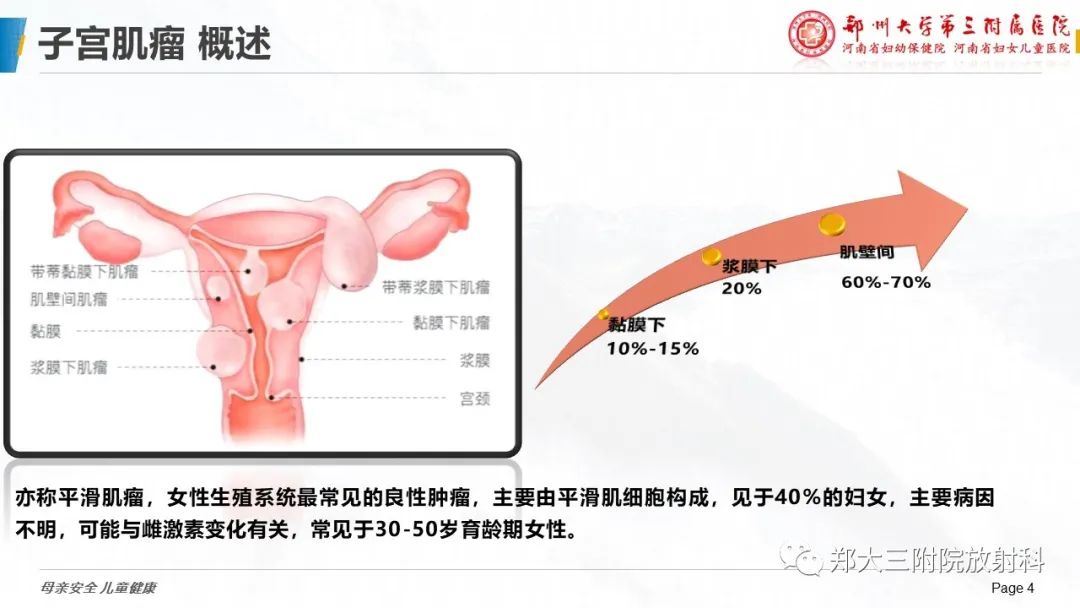 影像PPT - 【PPT】特殊生长方式的子宫肌瘤-4