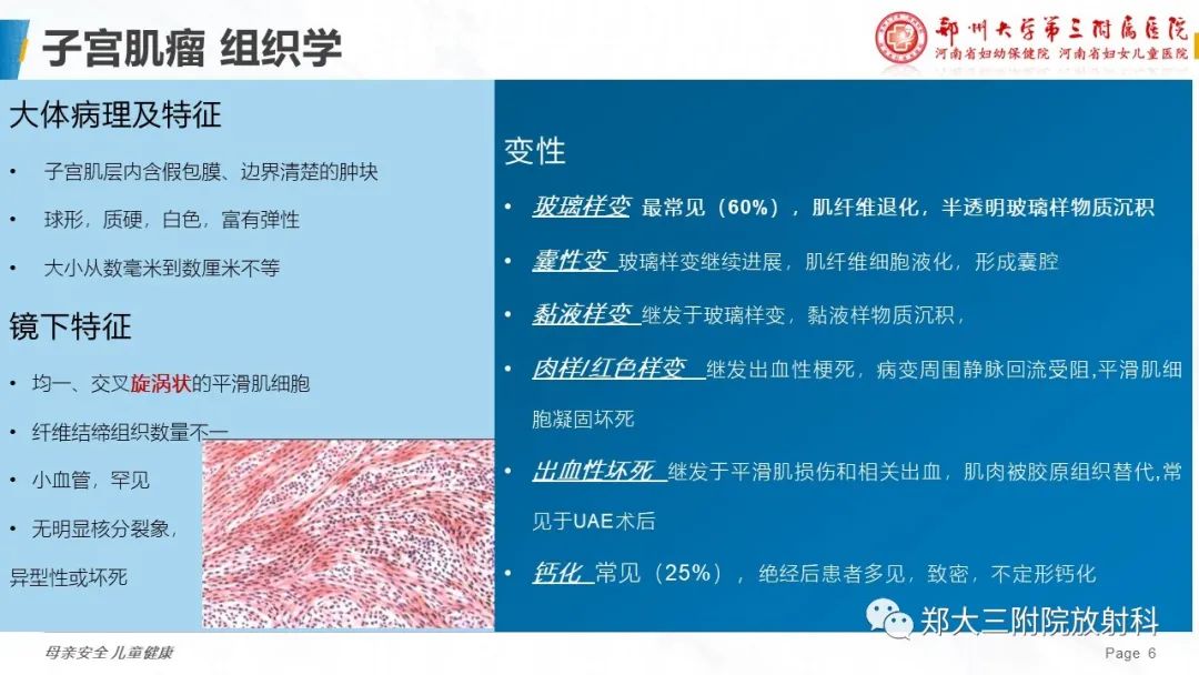 影像PPT - 【PPT】特殊生长方式的子宫肌瘤-6