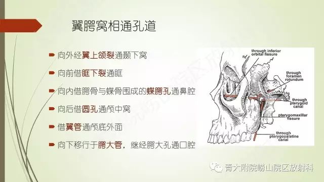 影像PPT - 【PPT】翼腭窝相通孔道-3